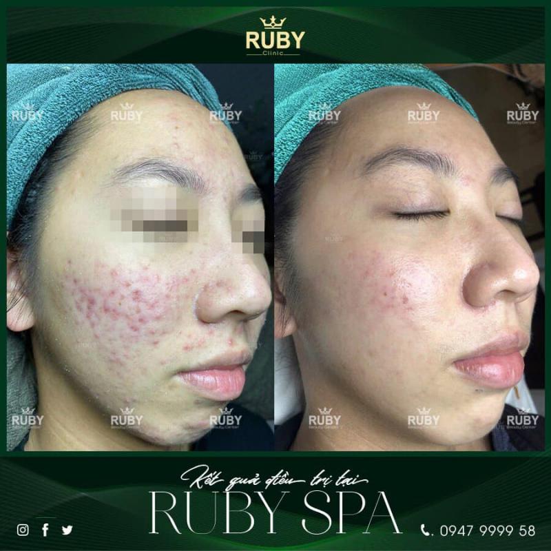 Ruby Spa