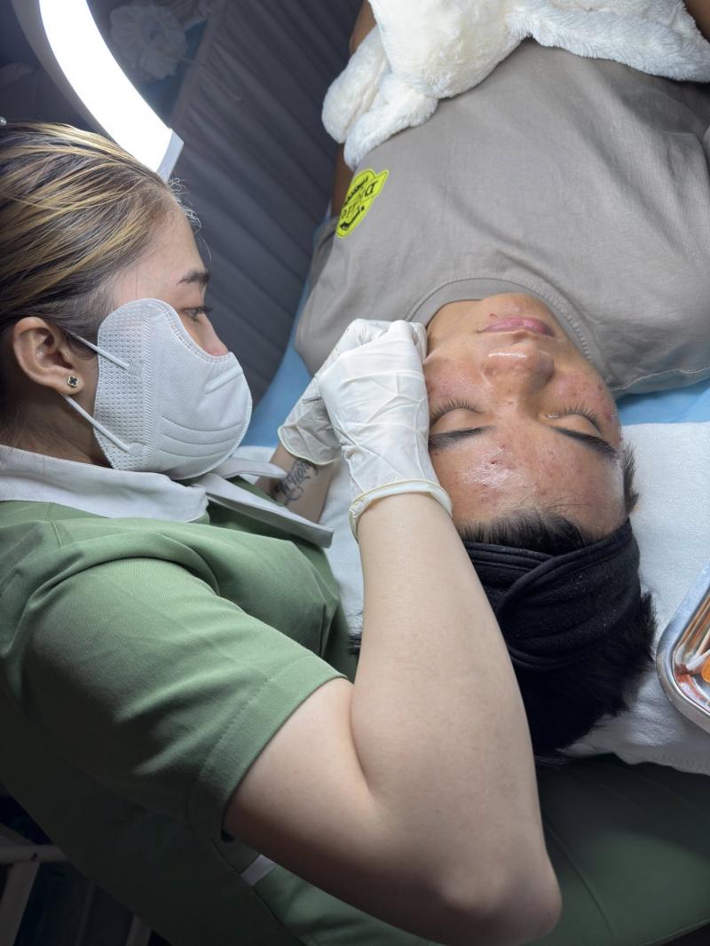 Sapphire Spa - Chuyên Gia Trị Mụn Tại Vũng Tàu