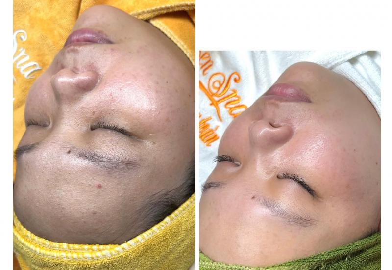 Sen Spa Đức Cơ - Gia Lai