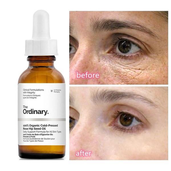 Serum giảm quầng thâm và bọng mắt The Ordinary Caffeine Solution 5% + EGCG