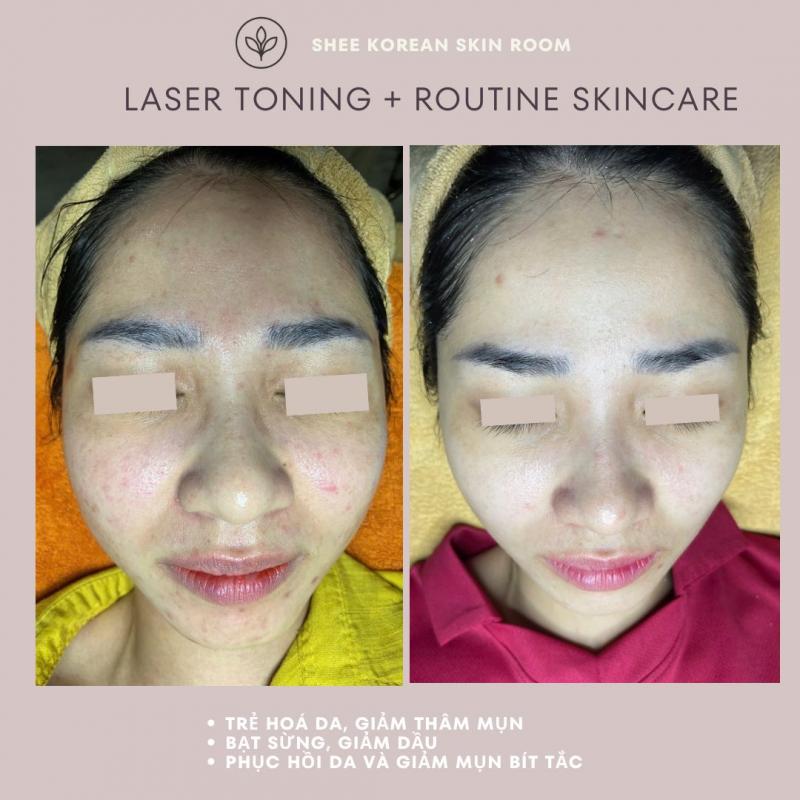 SHEE SPA Buôn Ma Thuột