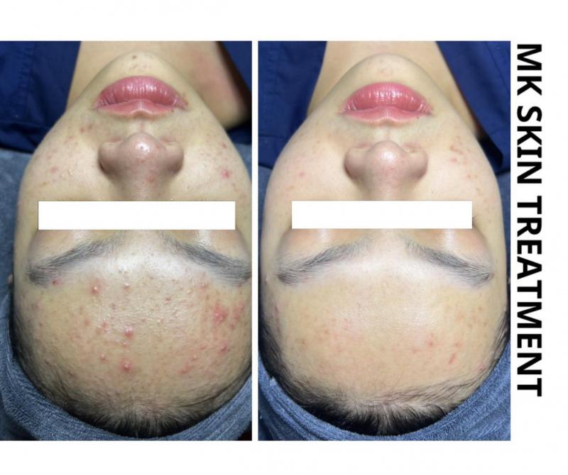 SHEE SPA Buôn Ma Thuột