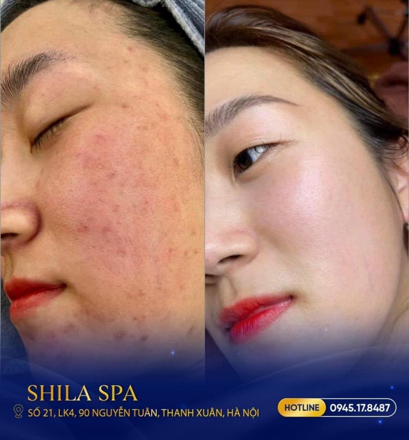 Shila Spa