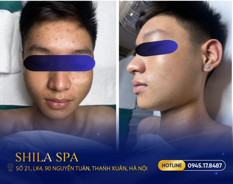 Shila Spa