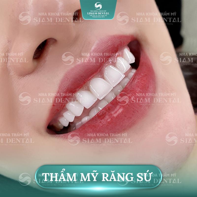 Siam Dental chi nhánh Hồ Chí Minh