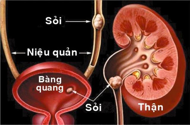 Loại bệnh khi ăn tối muộn