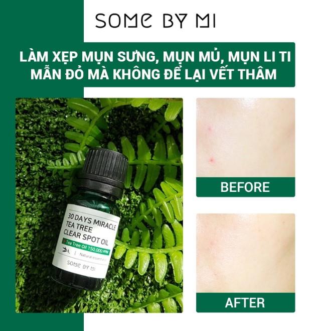 Some By Mi 30 Days Miracle Tea Tree Clear Spot Oil