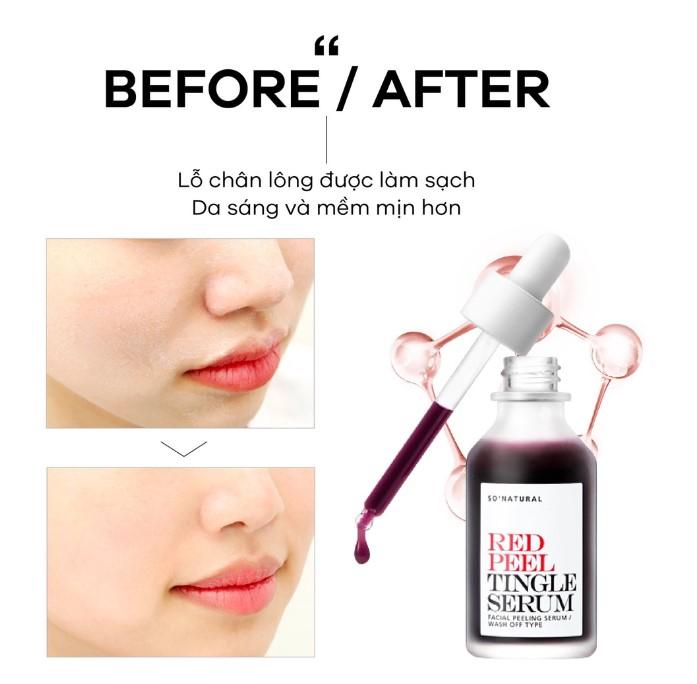 So'Natural Red Peel Tingle Serum