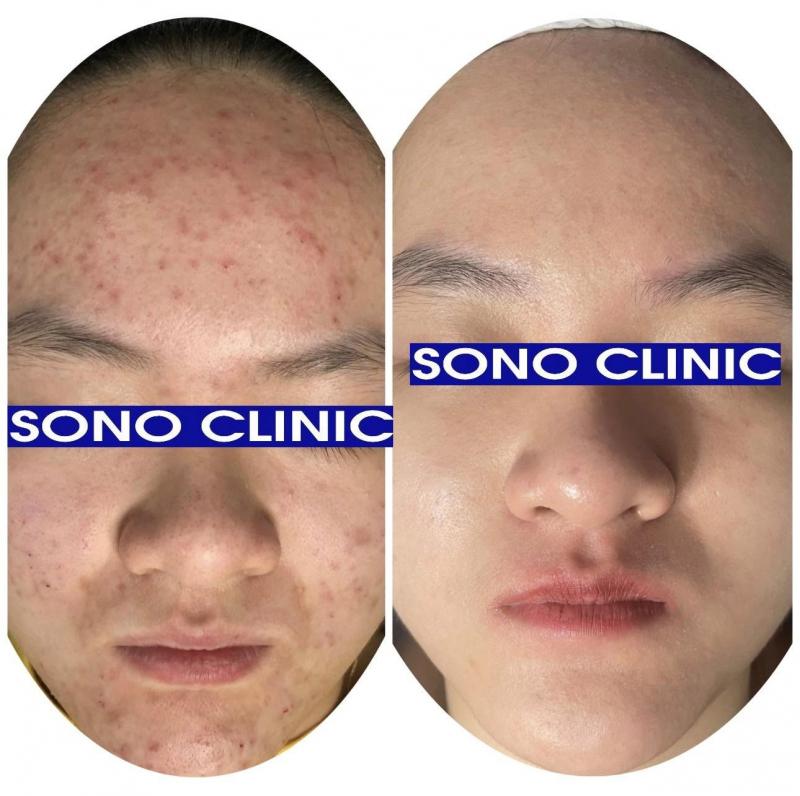 SONO Clinic - Phòng khám Da liễu Thẩm mỹ