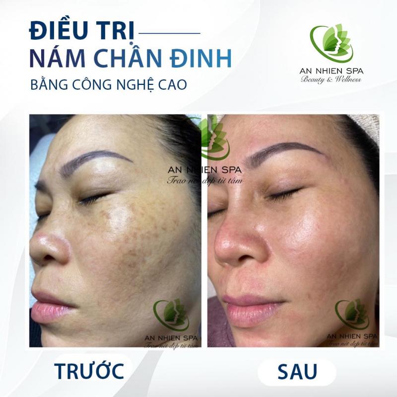 Spa An Nhiên - Bà Rịa