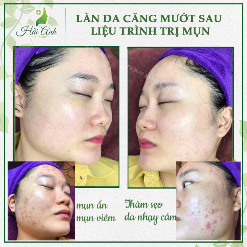 Spa Hải Anh