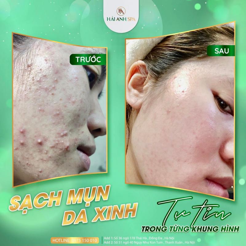 Spa Hải Anh