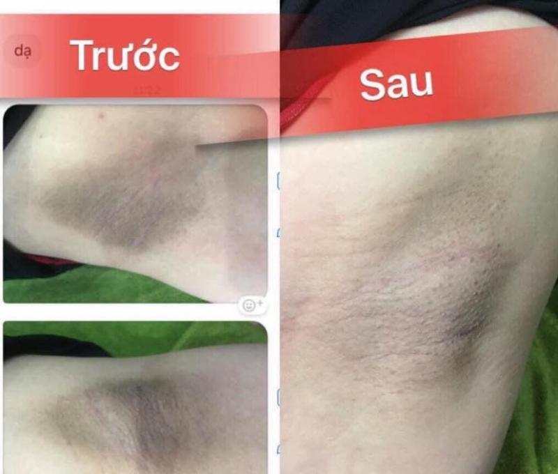 Spa Nét Huế