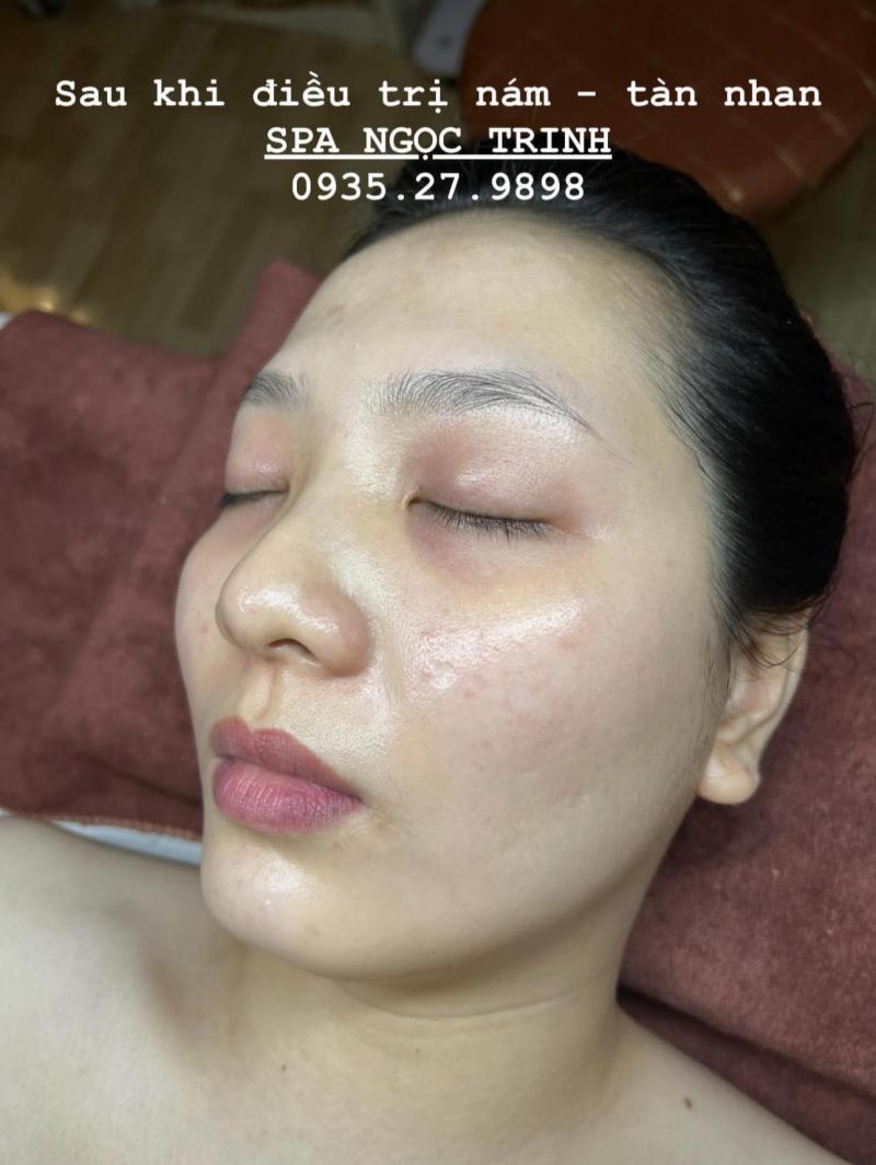 Spa Ngọc Trinh