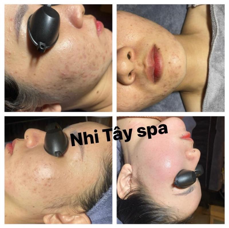 Spa Nhi Tây Phan Thiết