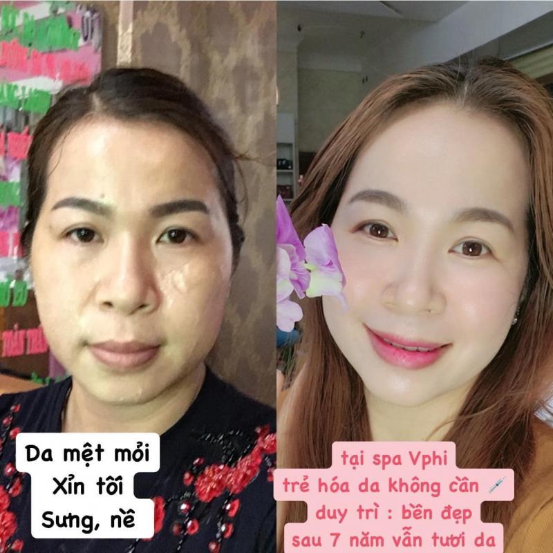 Spa Vương Phi