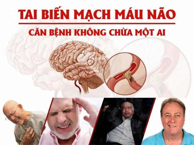 Tai biến mạch máu não (đột quỵ) là tình trạng não bị thiếu máu nuôi đột ngột ở toàn bộ hay một phần