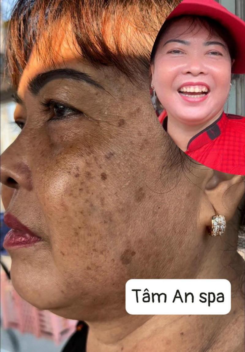 Tâm An Spa