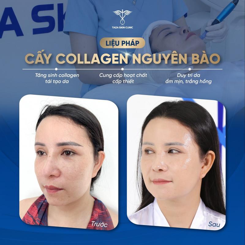 Taza Skin Clin﻿﻿﻿ic