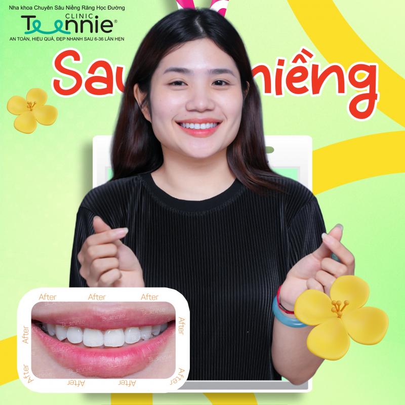 Teennie – Nha Khoa Học Đường | Niềng Răng Uy Tín tại TP. Hồ Chí Minh