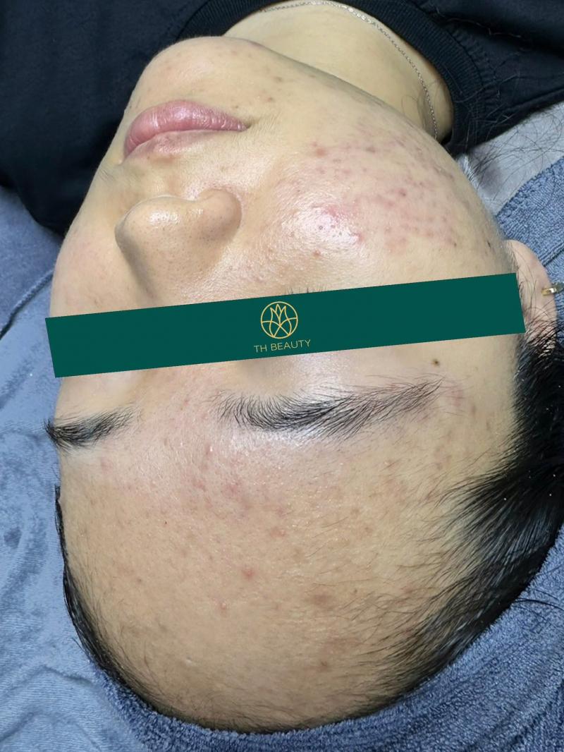 TH Beauty Hà Đông