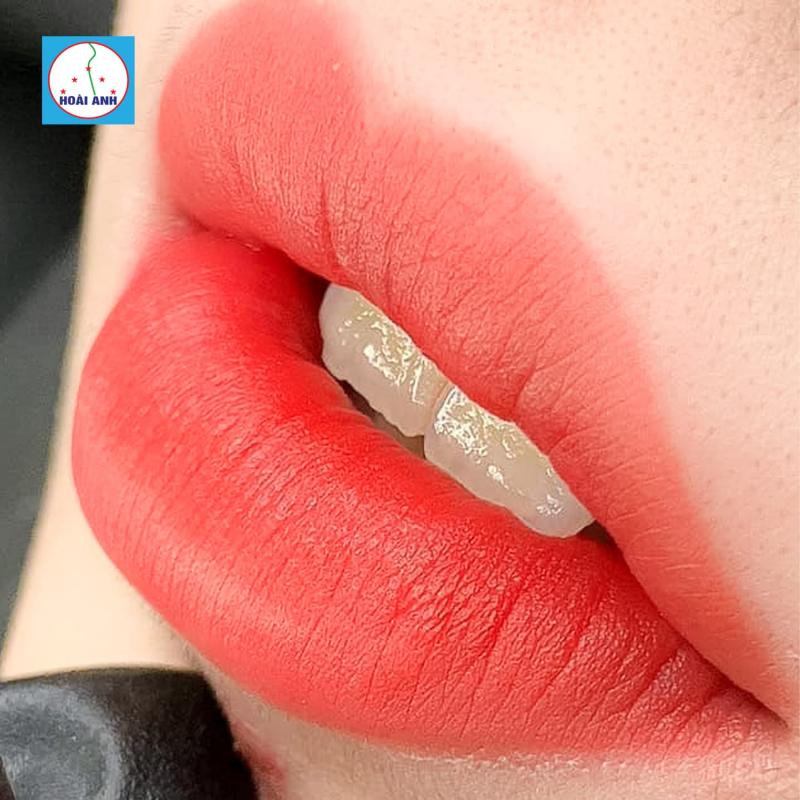 Thẩm mĩ viện Hoài Anh