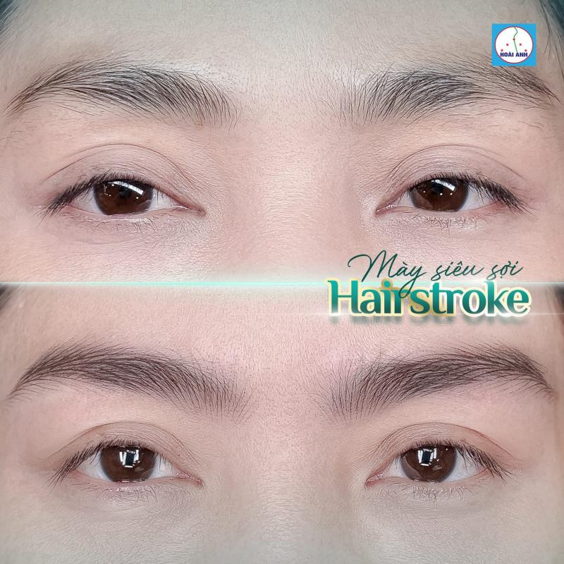 Thẩm mĩ viện Hoài Anh