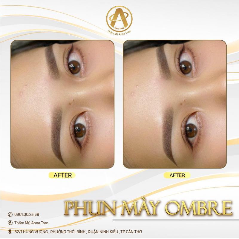 Thẩm Mỹ Anna Trần