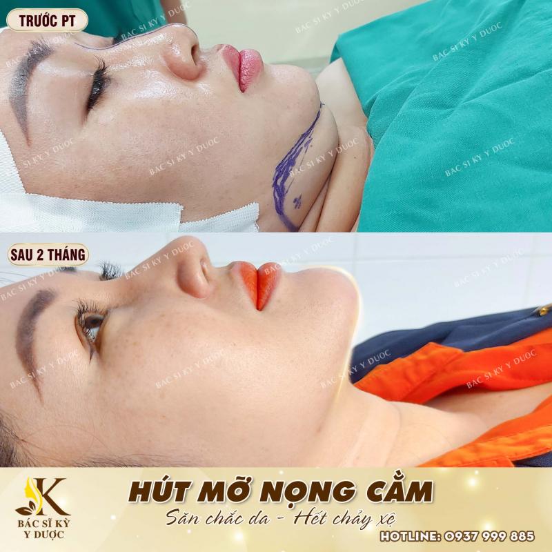 Thẩm mỹ Bác sĩ Kỳ Y Dược - Nha Trang