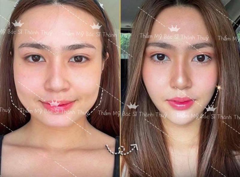 Thẩm mỹ bác sĩ Thành Thủy