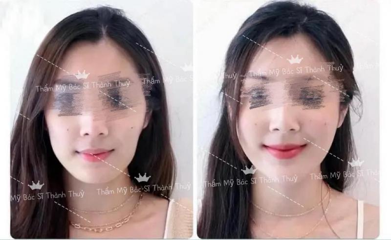 Thẩm mỹ bác sĩ Thành Thủy