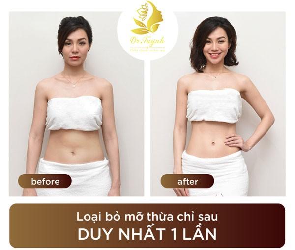 Thẩm mỹ bác sỹ Tuynh