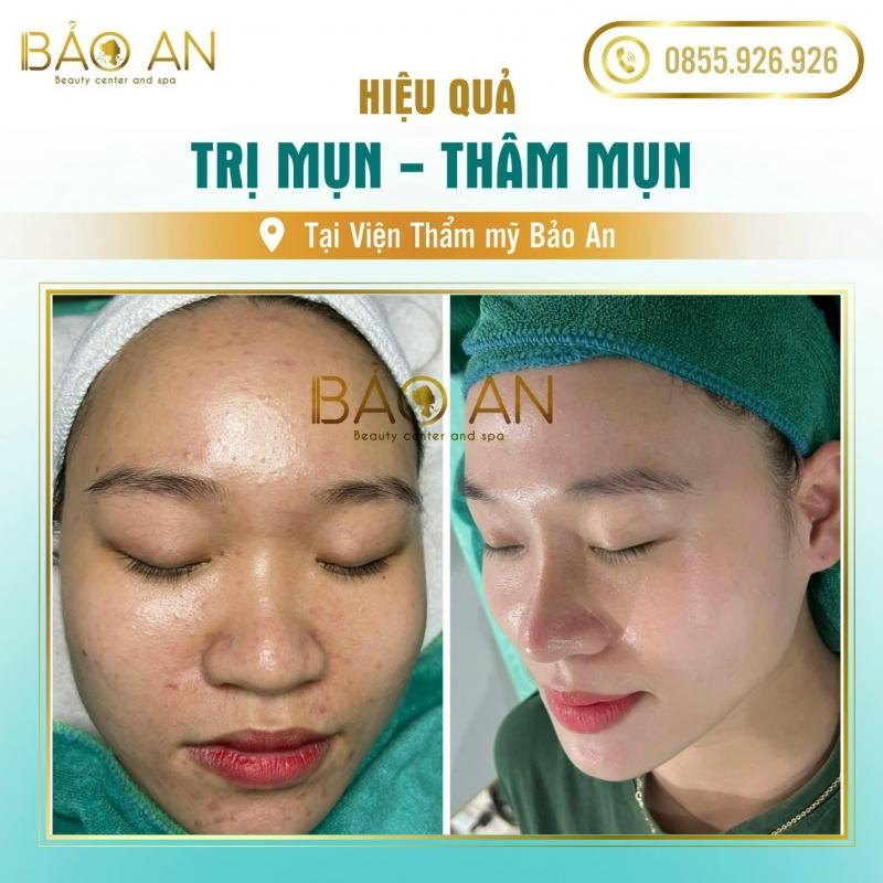 Thẩm Mỹ Bảo An