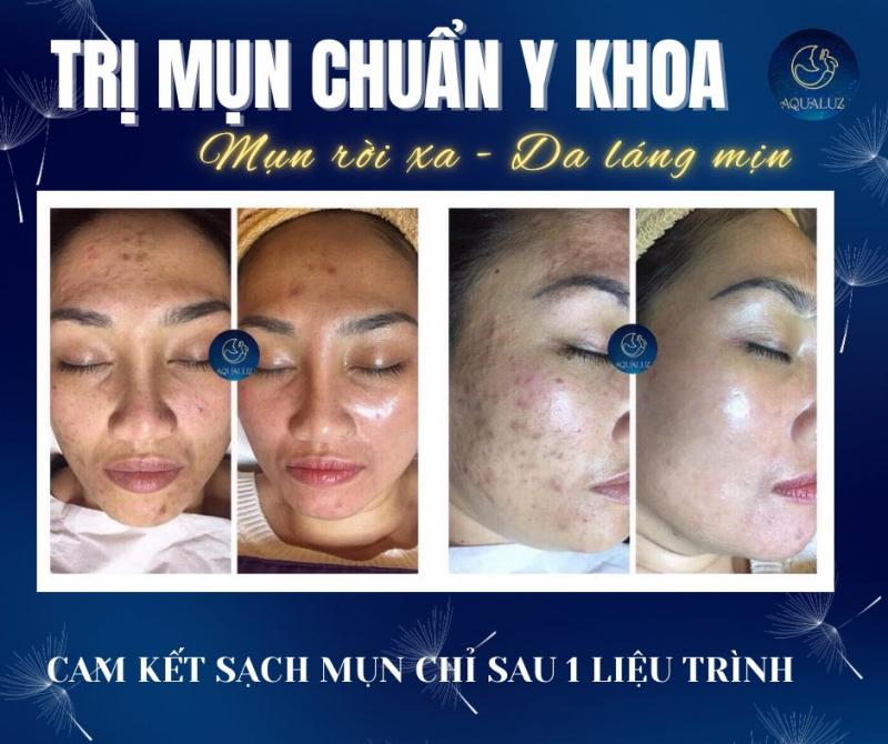 Thẩm mỹ công nghệ cao Aqualuz