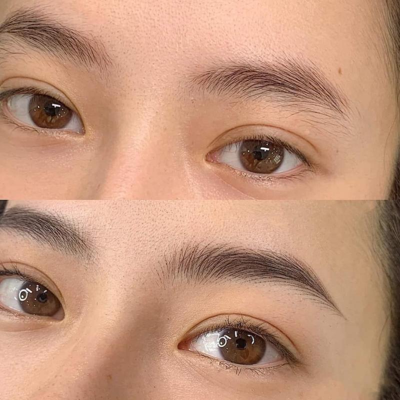 Thẩm Mỹ Công Nghệ Cao Hiệp Thành