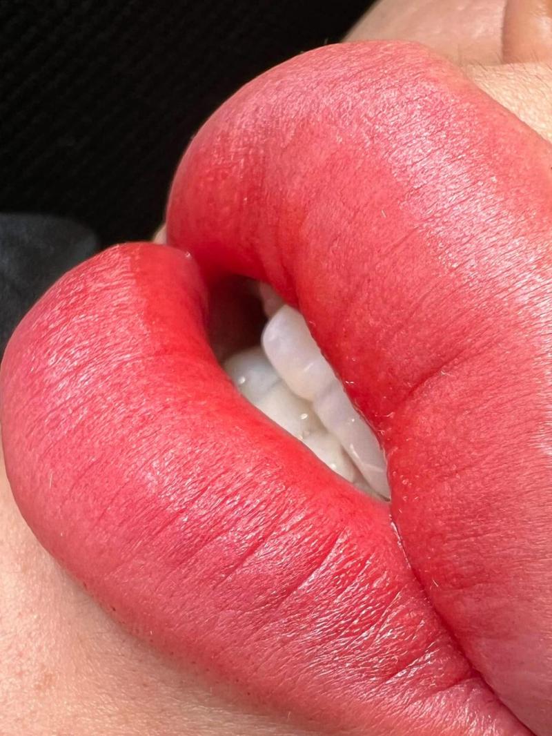 Thẩm Mỹ Công Nghệ Cao Hiệp Thành