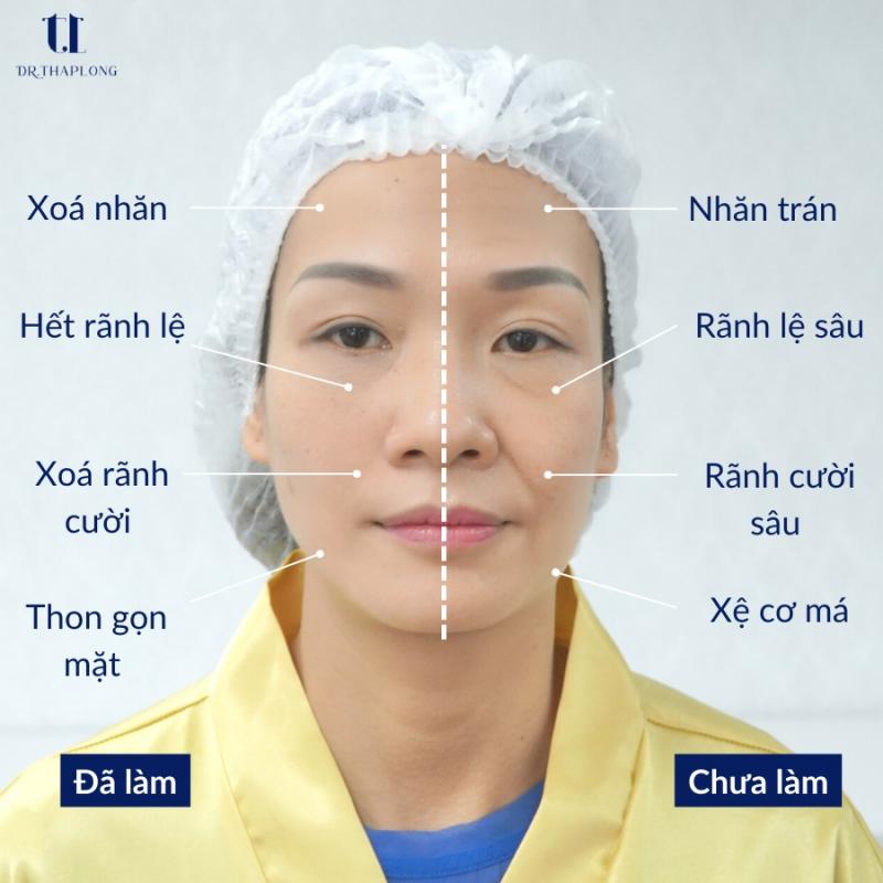 Thẩm mỹ da Quốc tế Dr Tháp Long