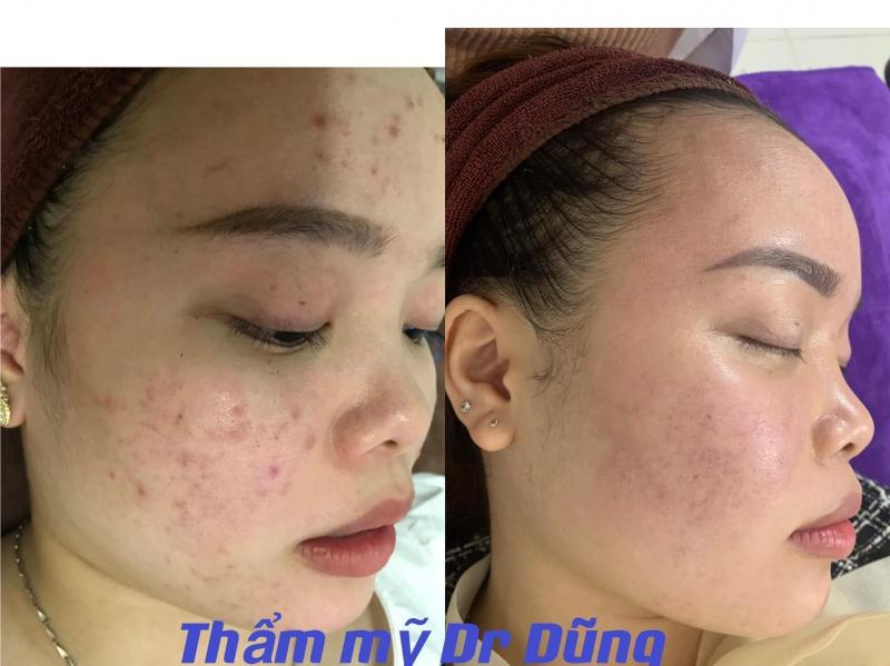 Thẩm mỹ Dr Dũng