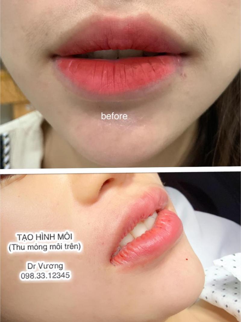 Thẩm mỹ Dr Vương