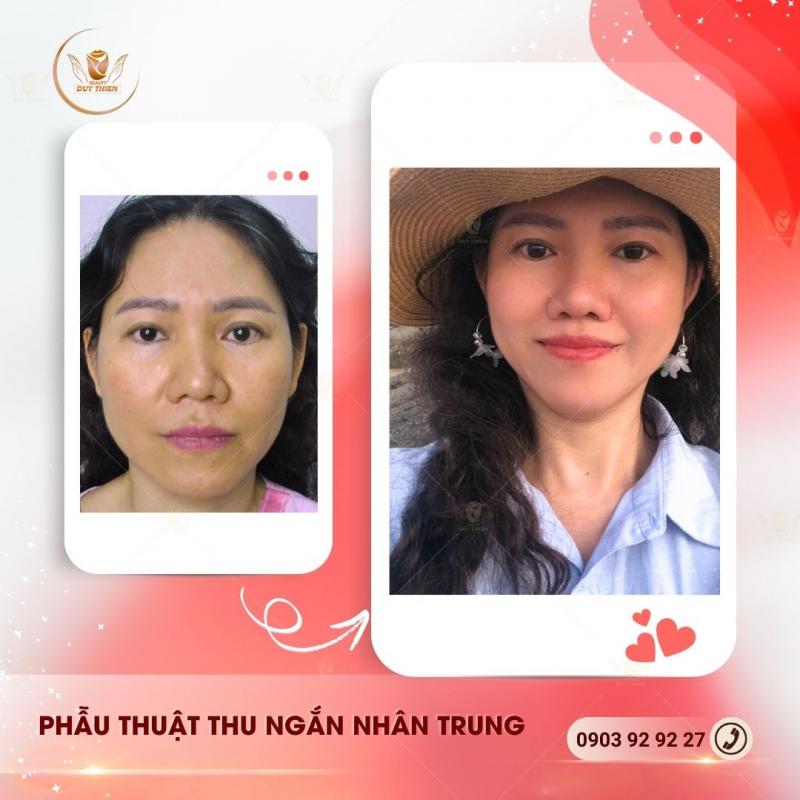 Thẩm Mỹ Duy Thiện