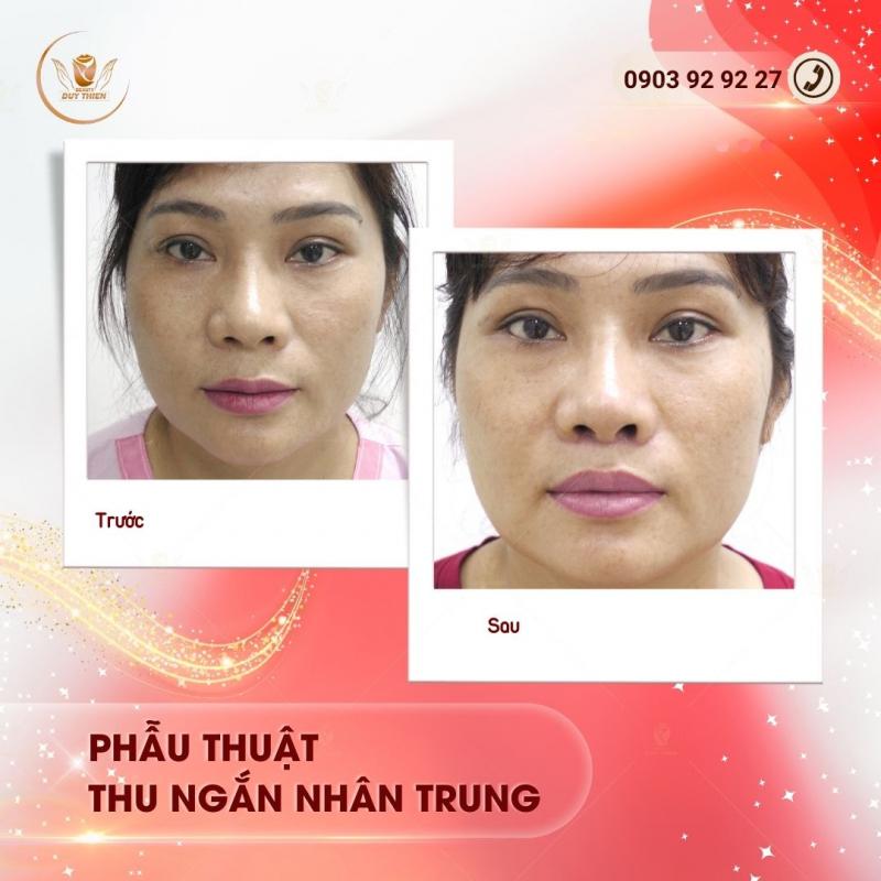 Thẩm Mỹ Duy Thiện