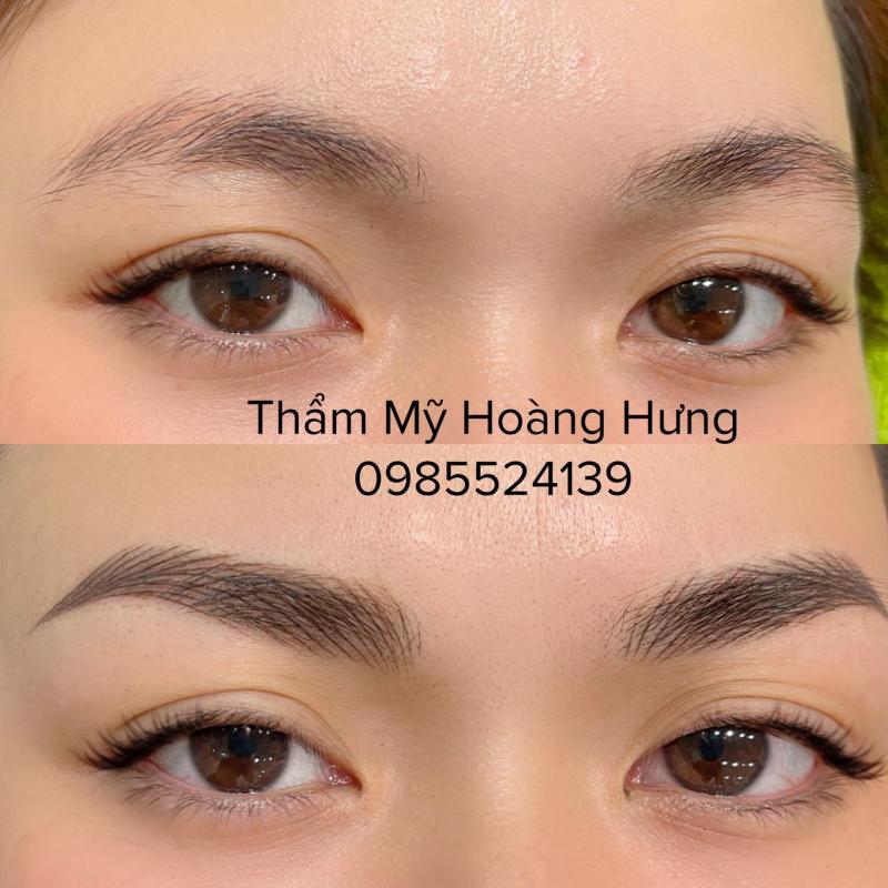 Thẩm Mỹ Hoàng Hưng