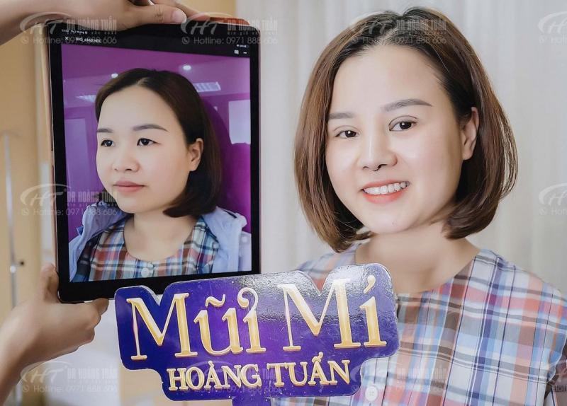 Thẩm mỹ Hoàng Tuấn - Hạ Long