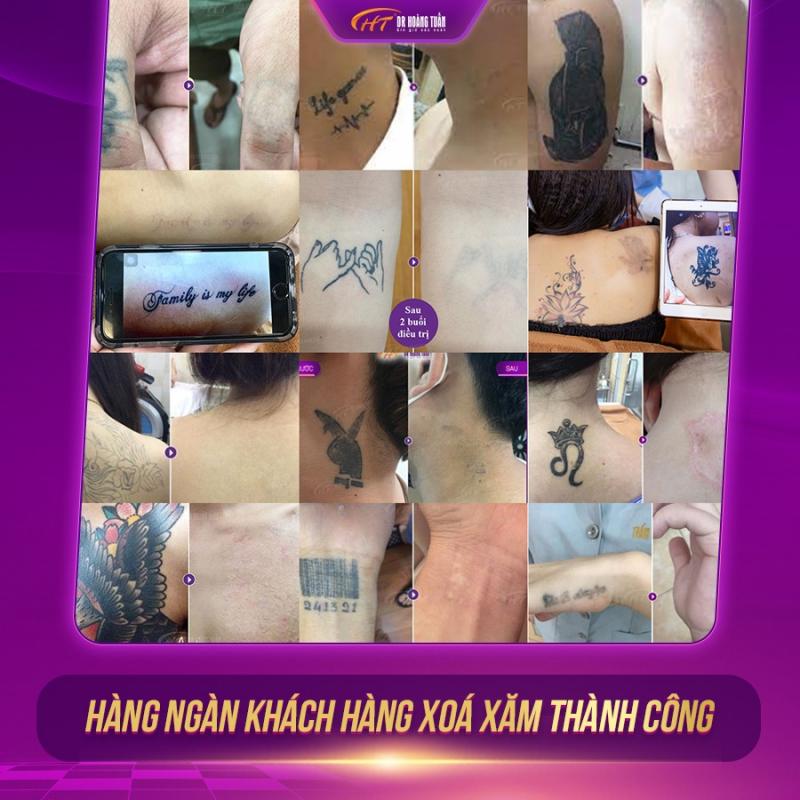 Thẩm mỹ Hoàng Tuấn