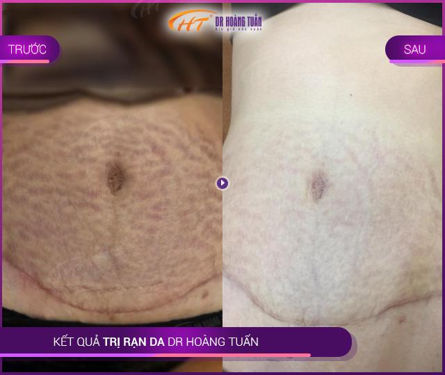 Thẩm mỹ Hoàng Tuấn