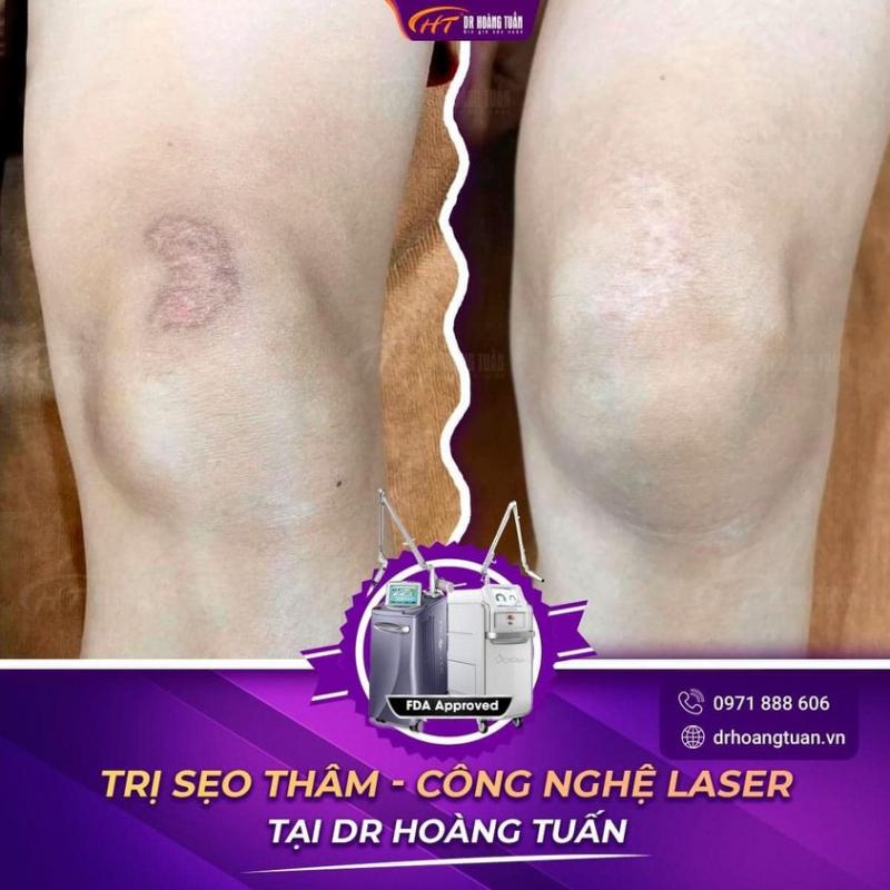 Hoang Tuan Cosmetology