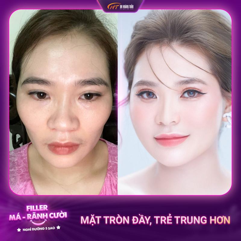 Thẩm Mỹ Hoàng Tuấn Hải Phòng