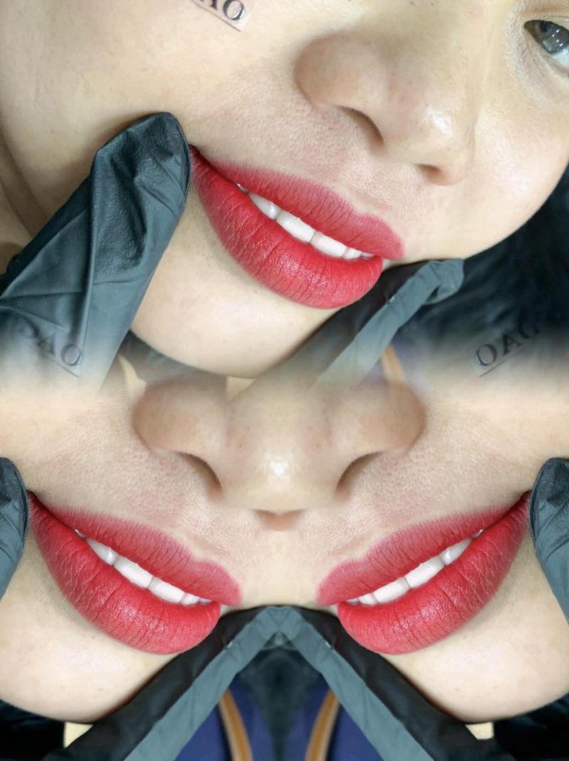 Thẩm Mỹ Hồng Đào - Long Xuyên