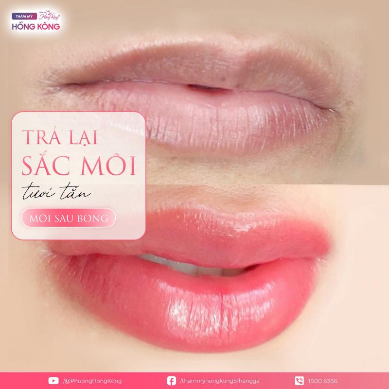 Thẩm mỹ Hồng Kông