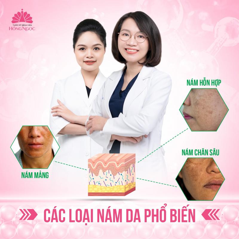 Điều trị nám cho khách hàng